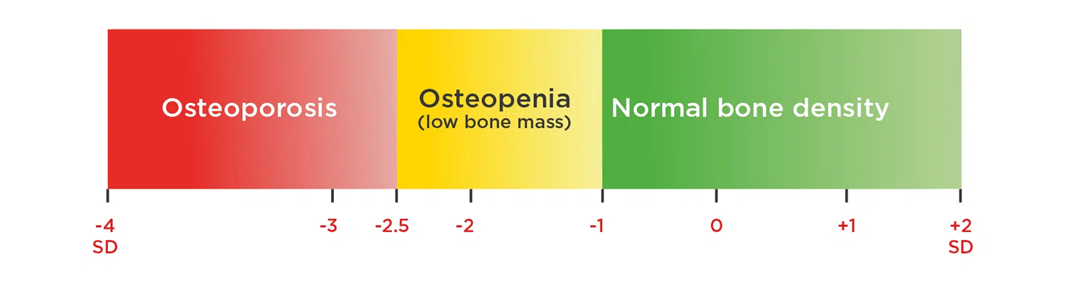 bone mineral density score